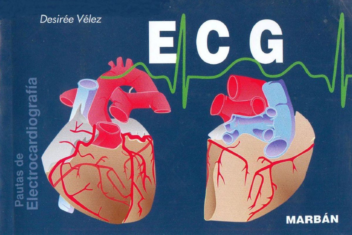 ELECTROCARDIOGRAMA INTERPRETACIÓN (EKG)